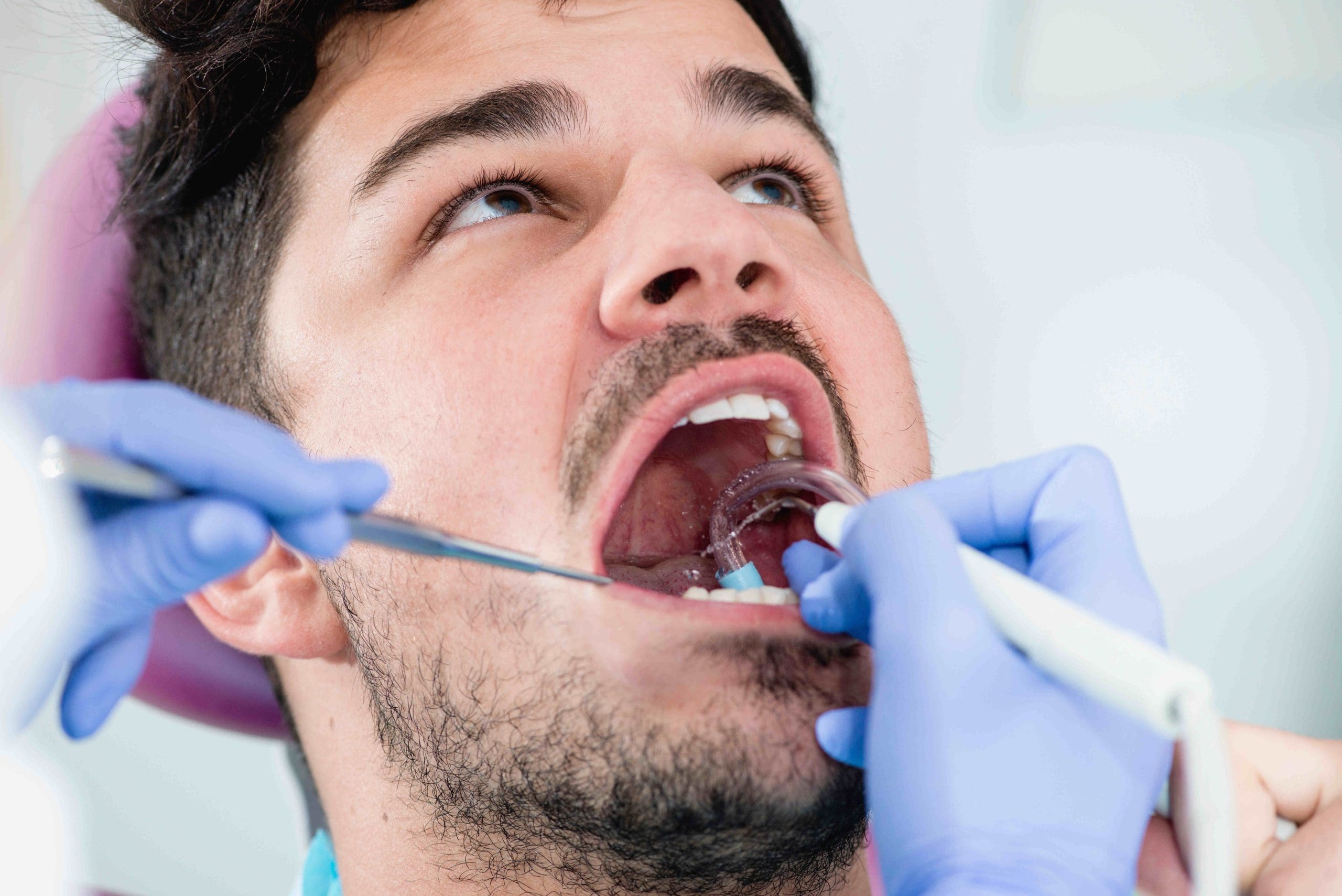 Pain After Dental Cleaning? Tips to Soothe Your Discomfort