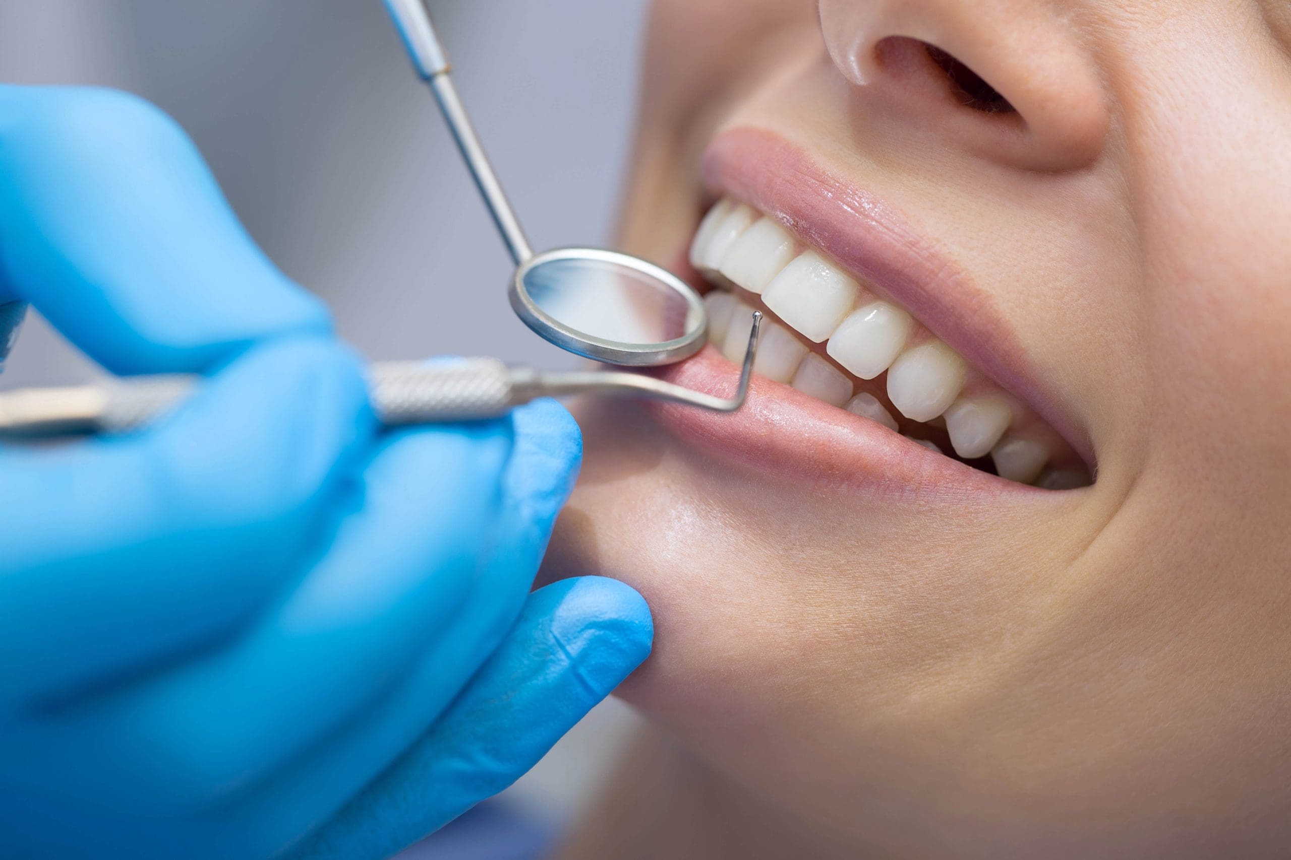 Teeth Cleaning for Braces: Essential Tips for Clean Teeth