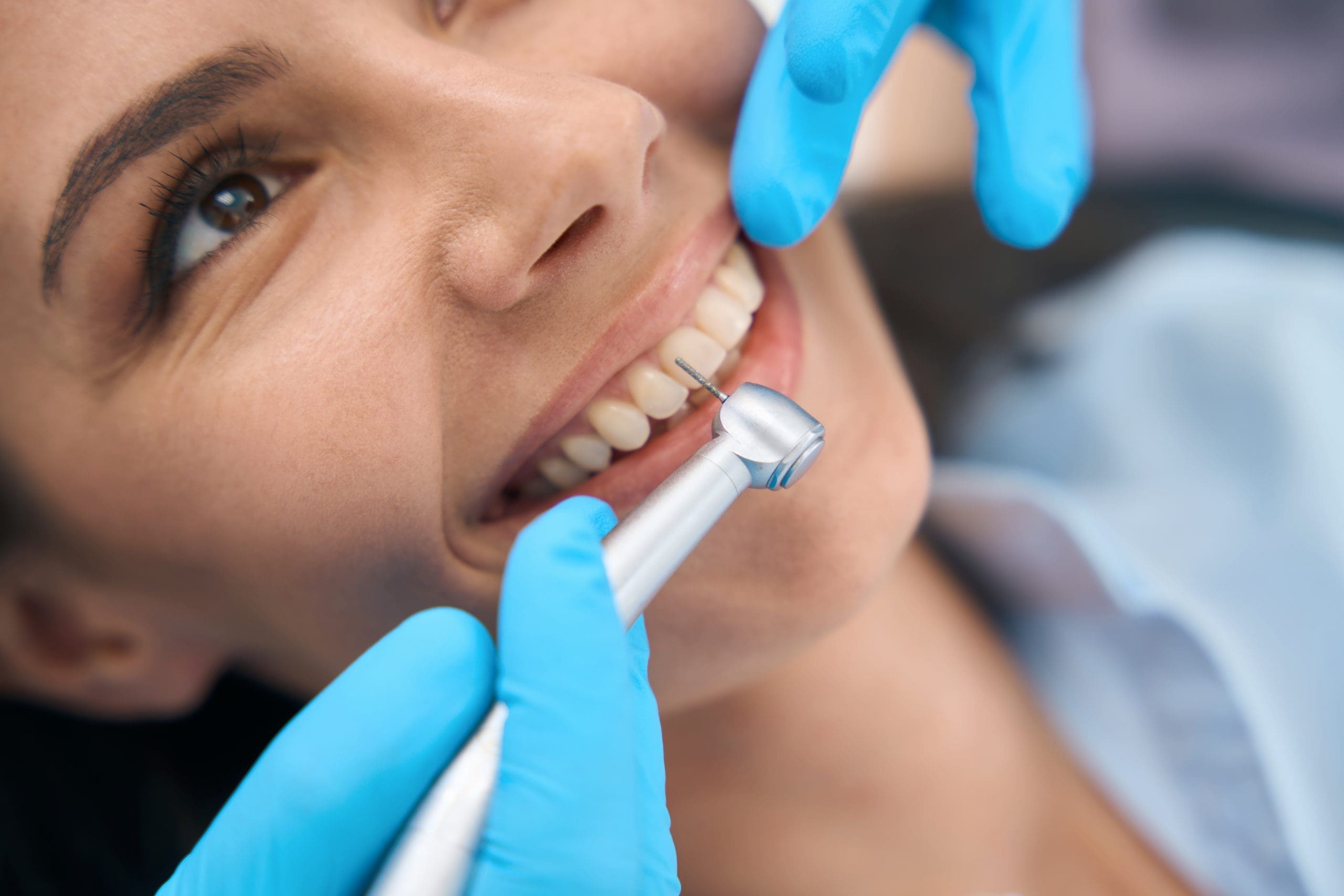 Yorba Linda Root Canal Therapy